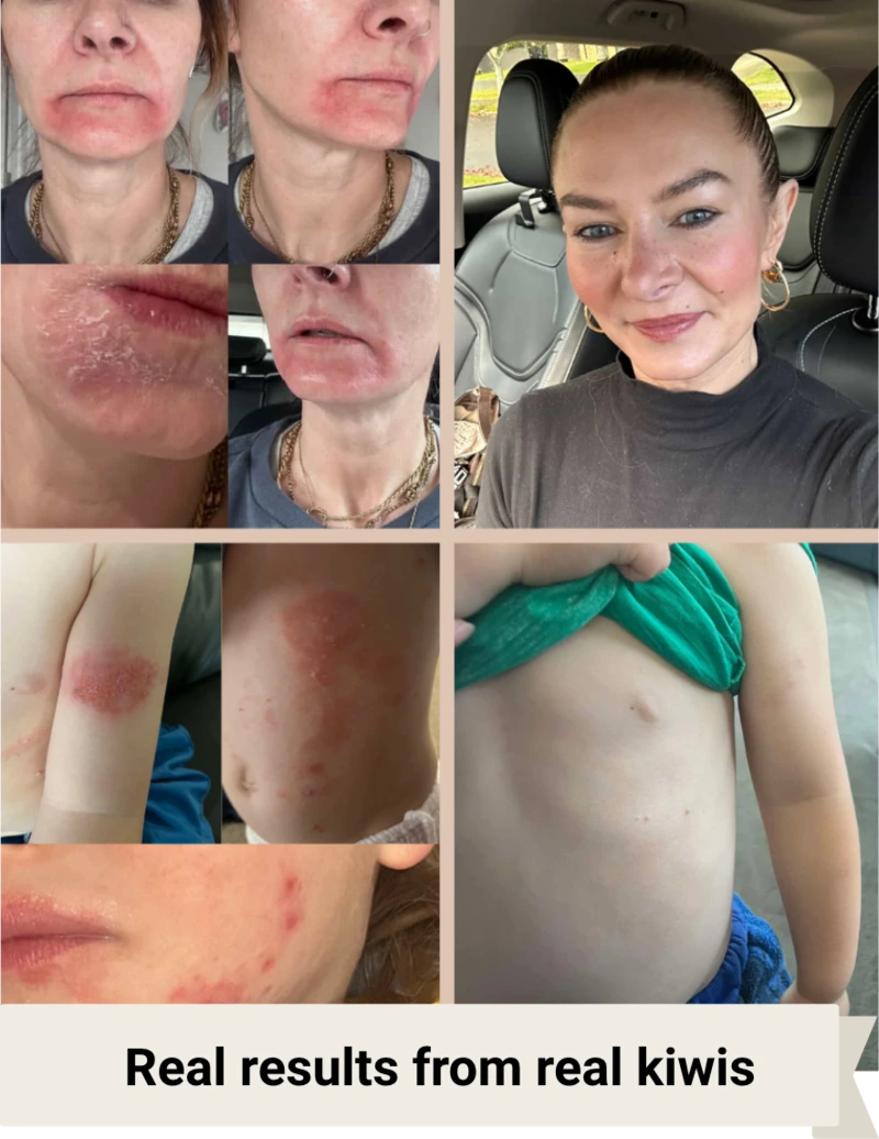 Tallow balm before and after results